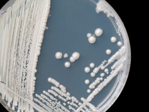 التهاب ملحقات الرحم.. الأعراض والعلاج