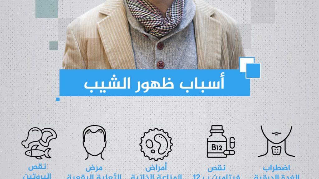 ما السن الطبيعية لظهور الشيب؟ وما أسبابه في عمر الـ20؟