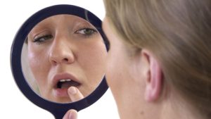 هذه أسباب تشقق الشفاه