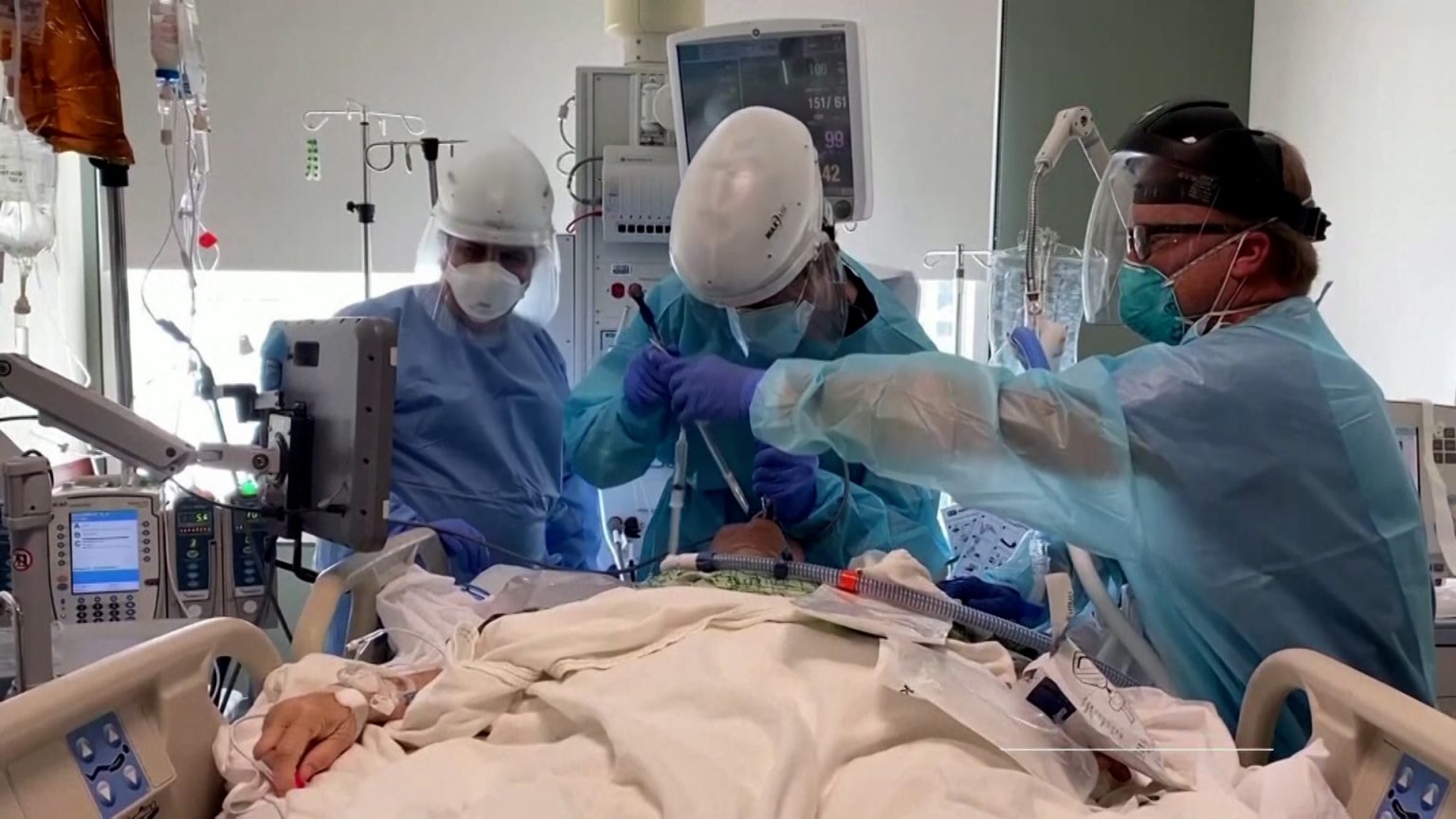 الهند تكتشف 1640 إصابة بمتحور كورونا الجديد “جيه إن 1”