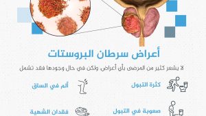 ماذا تعرف عن سرطان البروستاتا الذي غيب سيد البنتاغون عن العالم؟