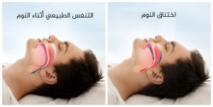 نومك أقل من 7 ساعات يوميا يهددك بهذا المرض الخطير