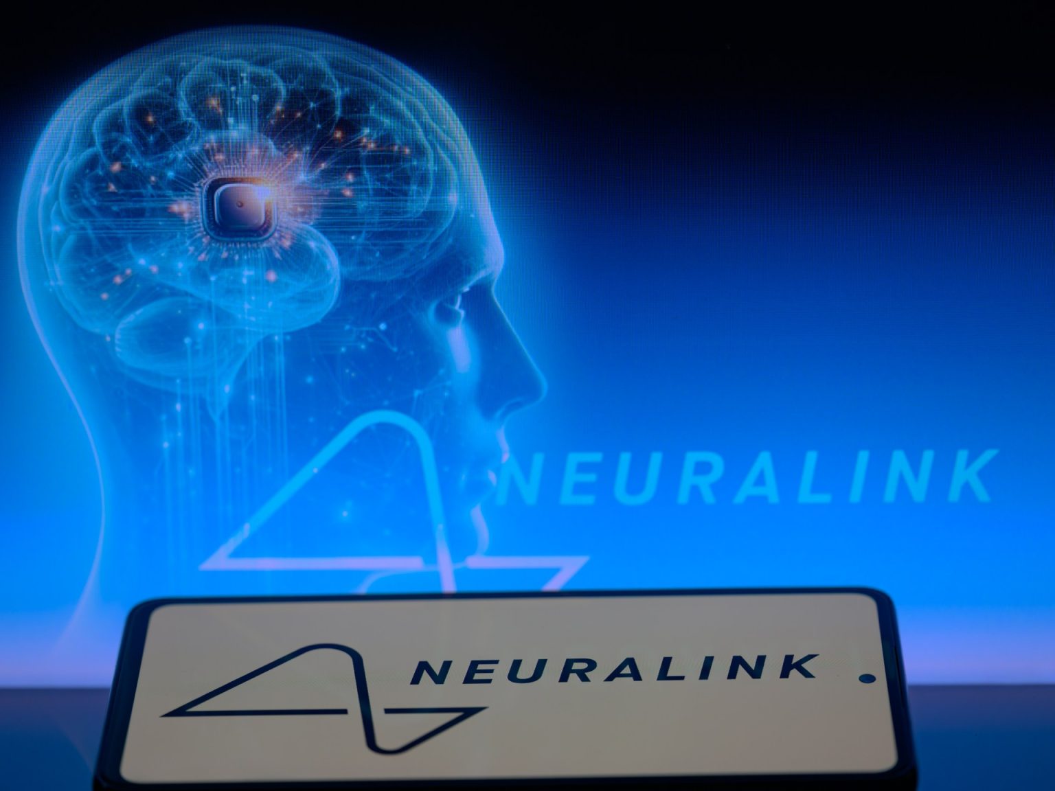 مريض مصاب بالشلل يلعب الشطرنج بشريحة دماغية من “نيورالينك”