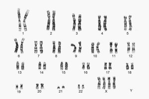متلازمة XXXX.. الأعراض والأسباب والعلاج