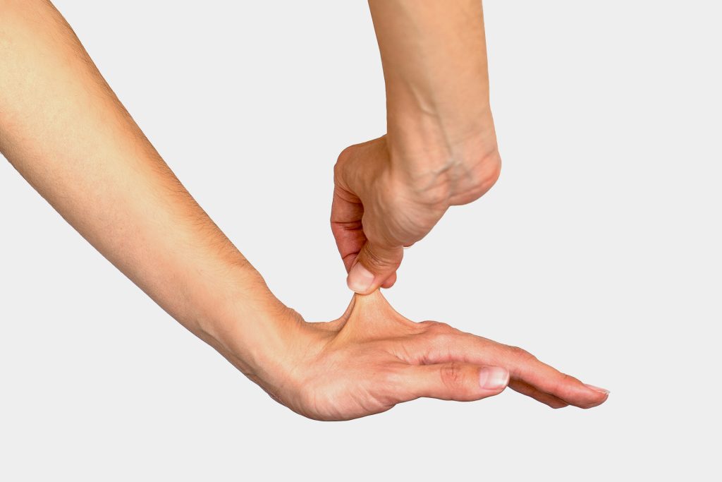 ما متلازمة إيلرز دانلوس؟