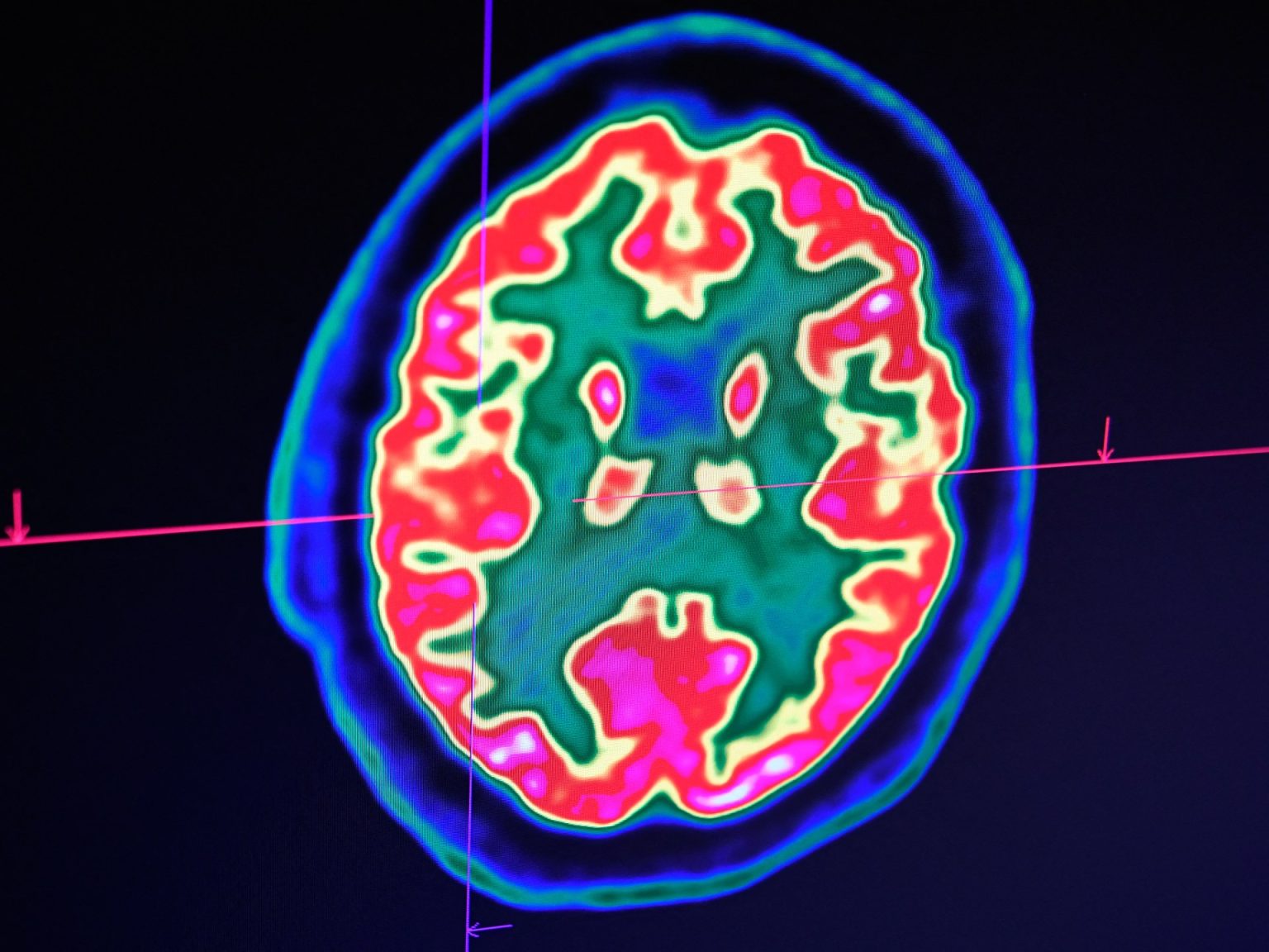 هذا ما يحدث للجسم قبل الموت بالترتيب.. وما هو أفضل شيء نفعله لشخص في ساعة الاحتضار؟