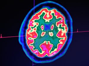 هذا ما يحدث للجسم قبل الموت بالترتيب.. وما هو أفضل شيء نفعله لشخص في ساعة الاحتضار؟