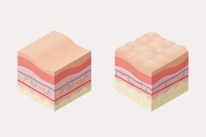 3 أسلحة لمحاربة السيلوليت