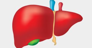 ما متلازمة بود شياري؟