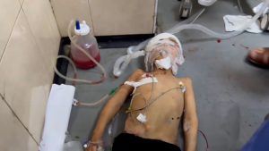 الأمم المتحدة تستنكر تعمد تحطيم الأجهزة الطبية المعقدة بمستشفيات غزة