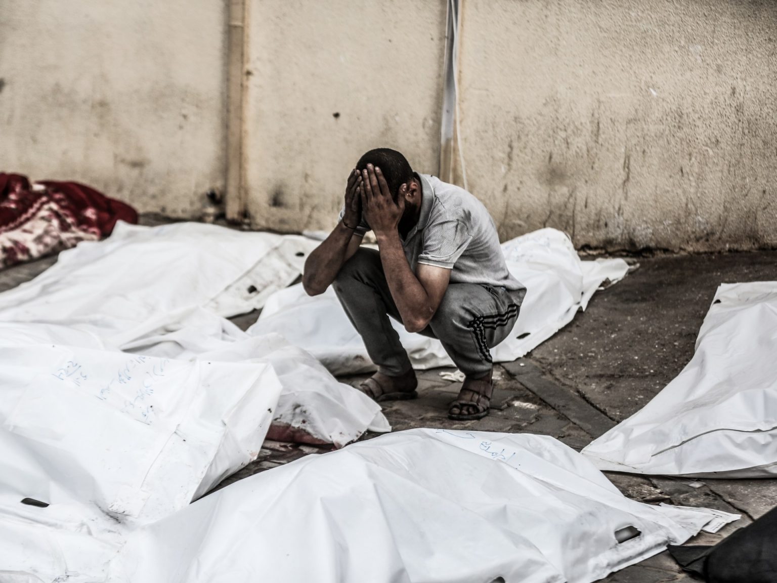 صحة غزة: مستشفى واحد يقدم الخدمات لمليون شخص بالقطاع