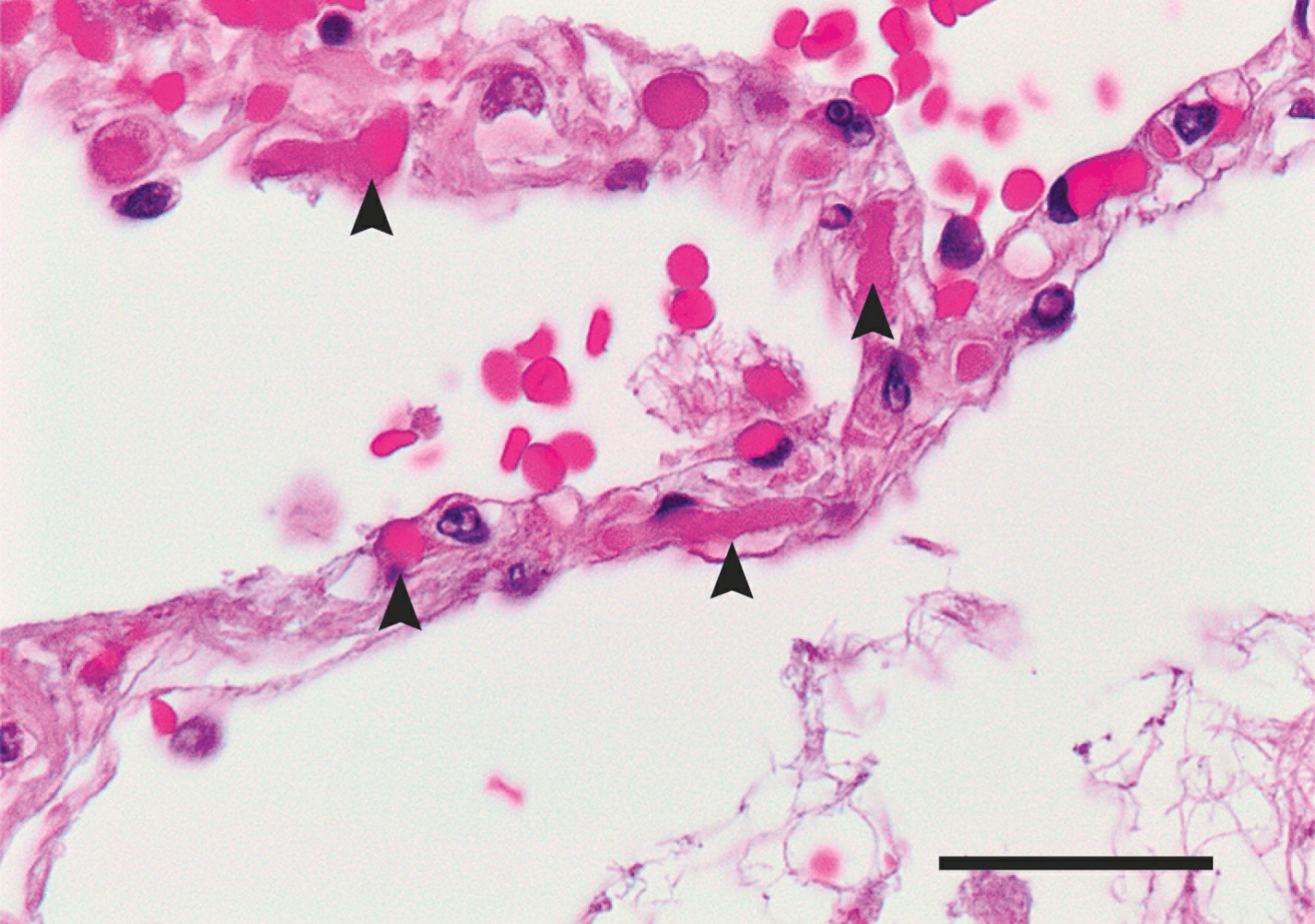 تطوير روبوتات هجينة بيولوجيا لعلاج السرطان