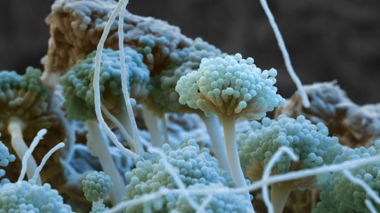 Emericella fungus, SEM Credit EYE OF SCIENCE / SCIENCE PHOTO LIBRARY