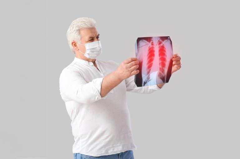 Senior man holding x-ray image of lungs on light background with space for text