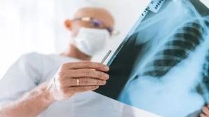 اكتشاف علاج جديد مبتكر لسرطان الرئة بنسبة نجاح تصل إلى 90%