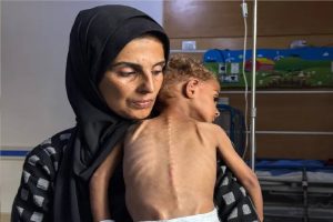 إسرائيل تصعّد في الضفة والقدس.. والتجويع يفتك بأطفال غزة