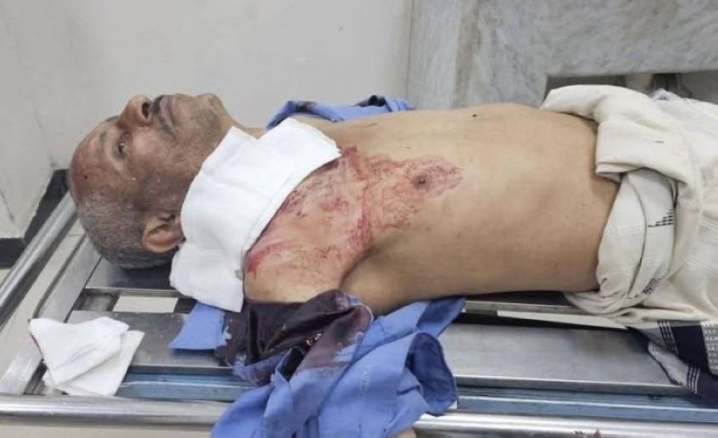 قتيل ومصابة.. حملة اختطافات حوثية في تعز