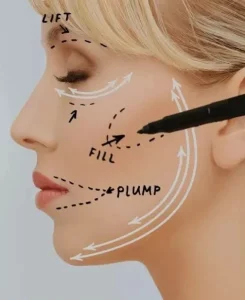 نقل الدهون الذاتية.. خيار تجميلي يعزز الملامح بنتائج طبيعية – أخبار السعودية
