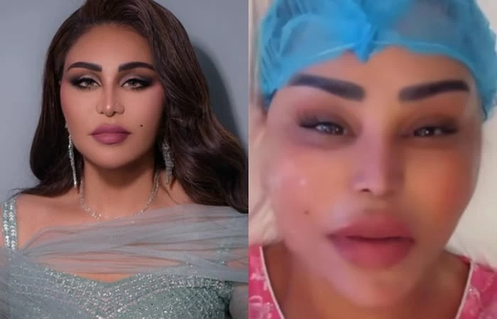 أحلام تكشف تفاصيل إجراء تجميلي جديد لشد الوجه – أخبار السعودية