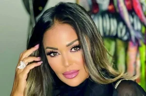 بعد العملية.. داليا البحيري تظهر بملامح أقرب لفيلم «سنة أولى نصب» – أخبار السعودية