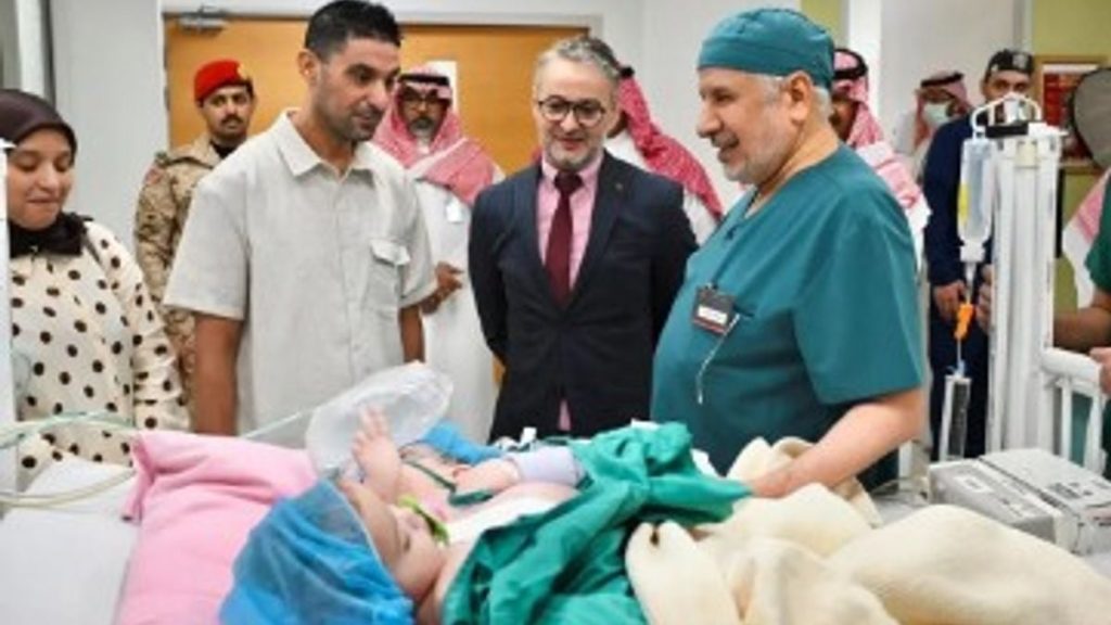 إنفاذًا لتوجيهات خادم الحرمين وولي العهد.. بدء عملية فصل التوأم الملتصق المغربي بالرياض