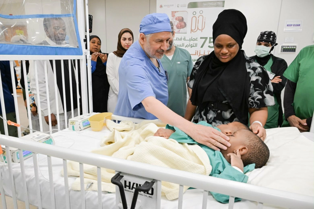 بدء عملية فصل التوأم الملتصق التنزاني في الرياض